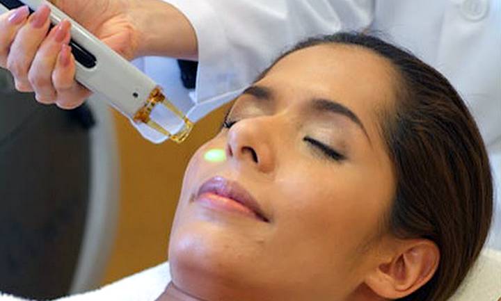 Excimer Laser Treatment