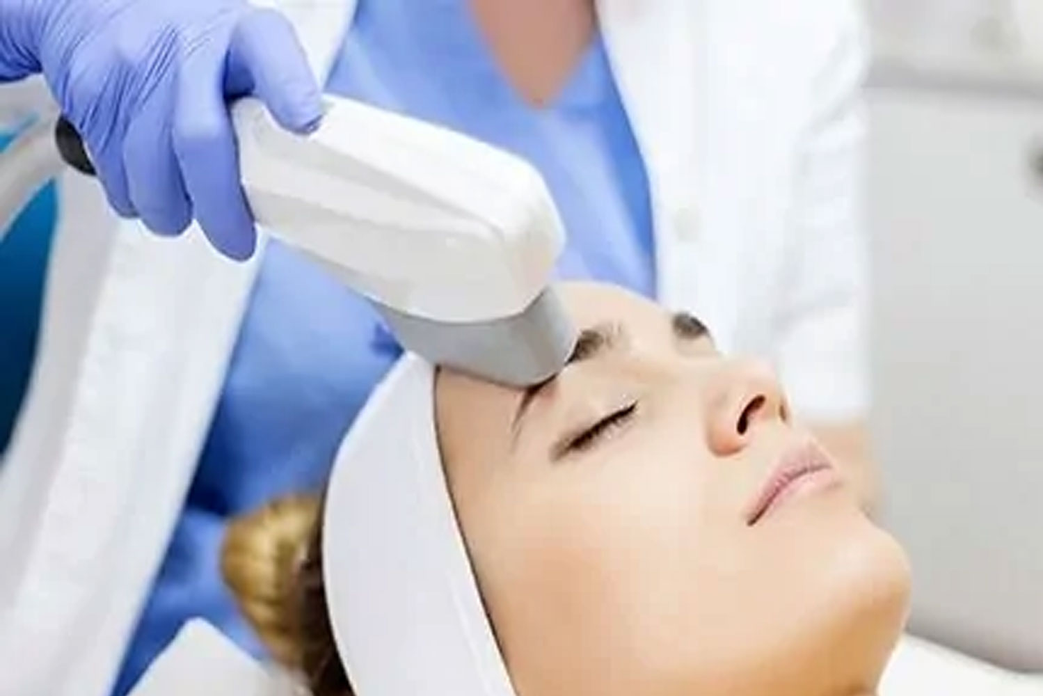 Excimer for Psoriasis