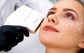 HIFU Skin Treatment