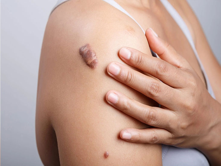 Cryotherapy Equipment